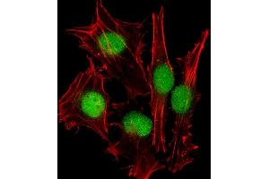 Immunofluorescent analysis of 4 % paraformaldehyde-fixed, 0. (SUMO1 anticorps)