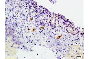 Formalin-fixed and paraffin embedded rat colitis labeled with Anti-CCR3 Polyclonal Antibody, Unconjugated  at 1:200 followed by conjugation to the secondary antibody and DAB staining.