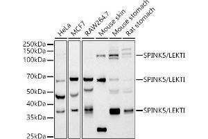 Western blot analysis of extracts of various cell lines, using SPINK5/LEKTI antibody (ABIN7270212) at 1:1000 dilution.