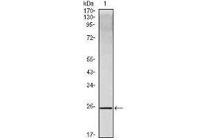Western Blot showing IL10 antibody used against IL10 recombinant protein.