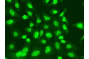 Immunofluorescence analysis of A549 cells using LIG1 antibody.