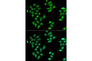 Immunofluorescence analysis of HeLa cells using ITLN1 antibody (ABIN5974359). (ITLN1/Omentin anticorps)