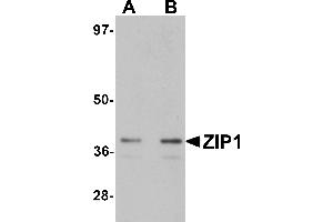 Western Blotting (WB) image for anti-Solute Carrier Family 39 (Zinc Transporter), Member 1 (SLC39A1) (N-Term) antibody (ABIN1031679)