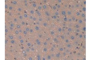 DAB staining on IHC-P; Samples: Rat Liver Tissue (Haptoglobin anticorps  (AA 70-332))