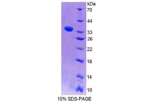 SDS-PAGE analysis of Rat WASP Protein. (WASP Protéine)