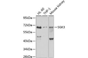 Western blot analysis of extracts of various cell lines, using SGK3 antibody (ABIN6132066, ABIN6147709, ABIN6147710 and ABIN6223495) at 1:1000 dilution.