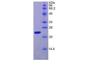 SDS-PAGE analysis of Human Relaxin 2 Protein.