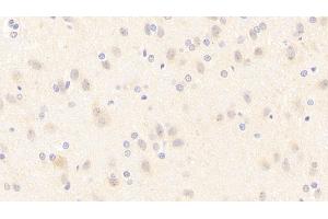 Detection of NOS1 in Rat Cerebrum Tissue using Polyclonal Antibody to Nitric Oxide Synthase 1, Neuronal (NOS1) (NOS1 anticorps  (AA 9-136))