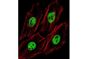 Fluorescent image of Hela cells stained with (Mouse) Trim24 Antibody (C-term) (ABIN6244019 and ABIN6577664). (TRIM24 anticorps  (C-Term))