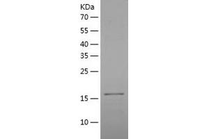 Western Blotting (WB) image for Tumor Necrosis Factor Receptor Superfamily, Member 11a, NFKB Activator (TNFRSF11A) (AA 28-202) protein (His-IF2DI Tag) (ABIN7125546)