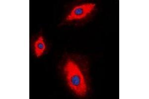 Immunofluorescent analysis of Granzyme A staining in HepG2 cells. (GZMA anticorps)