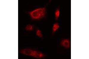 ABIN6274219 staining Hela cells by IF/ICC. (ITPKB anticorps  (Internal Region))