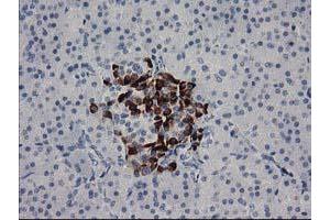 Immunohistochemical staining of paraffin-embedded Human pancreas tissue using anti-RGS5 mouse monoclonal antibody. (RGS5 anticorps)