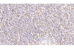 Detection of ATG16L1 in Human Spleen Tissue using Polyclonal Antibody to Autophagy Related Protein 16 Like Protein 1 (ATG16L1) (ATG16L1 anticorps  (AA 1-284))