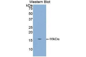Western Blotting (WB) image for anti-Cubilin (Intrinsic Factor-Cobalamin Receptor) (CUBN) (AA 3157-3274) antibody (ABIN1175674)