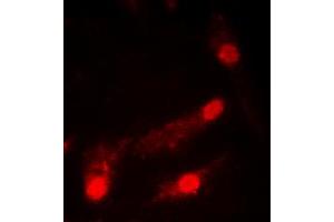 Immunofluorescent analysis of p53 (AcK386) staining in HeLa cells. (p53 anticorps  (acLys386, C-Term))
