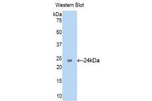 Western Blotting (WB) image for anti-Cell Division Cycle 25 Homolog B (S. Pombe) (CDC25B) (AA 377-566) antibody (ABIN1171796) (CDC25B anticorps  (AA 377-566))