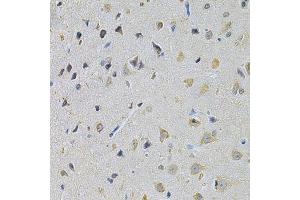 Immunohistochemistry of paraffin-embedded rat brain using PPA1 Antibody.