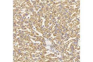 Immunohistochemistry of paraffin embedded rat liver using HSP60 (ABIN7074167) at dilution of 1: 1500 (300x lens)