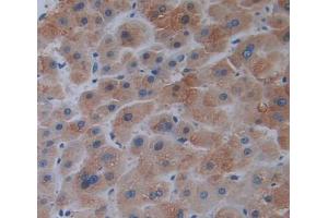 Used in DAB staining on fromalin fixed paraffin- embedded liver tissue