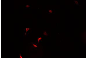 ABIN6266928 staining HeLa  cells by IF/ICC. (ZNF187 anticorps  (Internal Region))