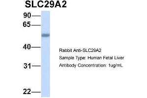 Host: Rabbit Target Name: SLC29A2 Sample Type: Human Fetal Liver Antibody Dilution: 1.