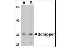 Western blot analysis of SCRAPPER in A20 cell lysate with this product at (A) 0.