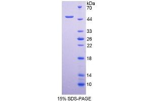 SDS-PAGE analysis of Human HCRP1 Protein. (VPS37A Protéine)