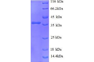 SDS-PAGE (SDS) image for NADH Dehydrogenase (Ubiquinone) 1 alpha Subcomplex, 2, 8kDa (NDUFA2) (AA 4-99), (partial) protein (GST tag) (ABIN5712267)