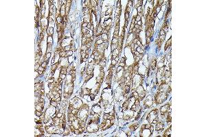 Immunohistochemistry of paraffin-embedded mouse stomach using J Rabbit pAb (ABIN7268040) at dilution of 1:100 (40x lens). (JAK2 anticorps)