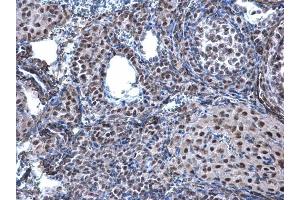 IHC-P Image CBX1 / HP1 beta antibody detects CBX1 / HP1 beta protein at nucleus on mouse ovary by immunohistochemical analysis. (CBX1 anticorps  (Center))