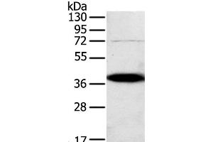 Western Blot analysis of A375 cell using SPARC Polyclonal Antibody at dilution of 1:500 (SPARC anticorps)