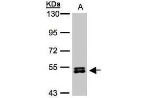 WB Image Sample(30 μg of whole cell lysate) A:HeLa S3, 7.