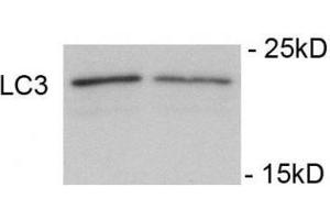 Immunoblots of SH-SY5Y cells treated with rapamycin for 1 h was probed with phospho-LC3C antibody. (LC3C anticorps  (pSer12))