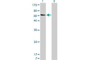 Western Blotting (WB) image for anti-Sorting Nexin 1 (SNX1) (AA 166-276) antibody (ABIN598935) (Sorting Nexin 1 anticorps  (AA 166-276))