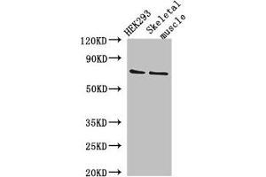 Western Blot Positive WB detected in: HEK293 whole cell lysate, Mouse skeletal muscle tissue All lanes: EFCAB7 antibody at 2. (EFCAB7 anticorps  (AA 1-158))