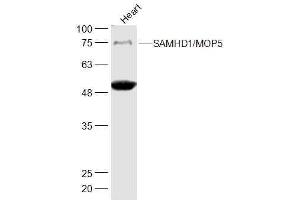 Mouse Heart lysates probed with SAMHD1'MOP5 Polyclonal Antibody, Unconjugated  at 1:500 dilution and 4˚C overnight incubation. (SAMHD1 anticorps  (AA 256-370))