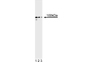 Western Blotting (WB) image for anti-PMS2 Postmeiotic Segregation Increased 2 (S. Cerevisiae) (PMS2) antibody (ABIN967525) (PMS2 anticorps)