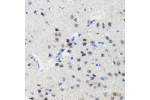 Immunohistochemistry of paraffin-embedded mouse brain using PIM1 antibody (ABIN7269375) at dilution of 1:100 (40x lens).