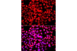 Immunofluorescence analysis of A549 cell using TDP1 antibody.