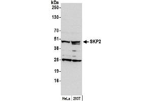 Western Blotting (WB) image for anti-S-Phase Kinase-Associated Protein 2 (SKP2) (AA 1-50) antibody (ABIN7450734)