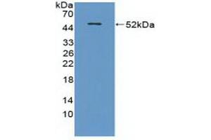 Detection of Recombinant CRAT, Mouse using Polyclonal Antibody to Carnitine Acetyltransferase (CRAT)