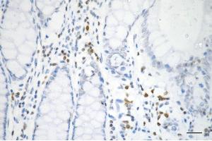 Immunohistochemistry was performed on paraffin-embedded human sigmoid colon carcinoma using histone H3 (tri methyl K27) antibody (ABIN7798967), 1:200). (Recombinant Histone 3 anticorps  (H3K27me3))