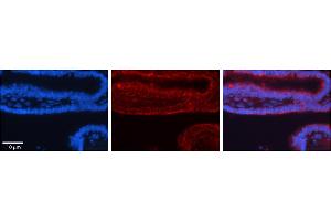 Rabbit Anti-TRIM32 Antibody  Catalog Number: ARP31692_P050  Formalin Fixed Paraffin Embedded Tissue: Human Bronchial Epithelial Tissue  Observed Staining: Cytoplasmic  Primary Antibody Concentration: 1:100  Secondary Antibody: Donkey anti-Rabbit-Cy3  Secondary Antibody Concentration: 1:200  Magnification: 20X  Exposure Time: 0.