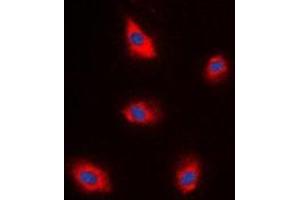 Immunofluorescent analysis of EPS8L1 staining in A549 cells. (EPS8-Like 1 anticorps)