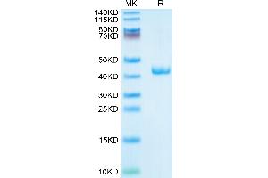 Human CXCL4 on Tris-Bis PAGE under reduced condition.