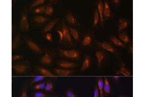 Immunofluorescence analysis of U-2 OS cells using NRBF2 Polyclonal Antibody at dilution of 1:100. (NRBF2 anticorps)