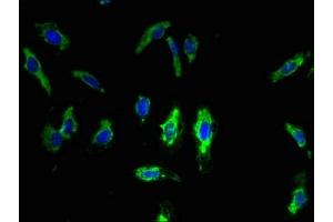 Immunofluorescent analysis of Hela cells using ABIN7173265 at dilution of 1:100 and Alexa Fluor 488-congugated AffiniPure Goat Anti-Rabbit IgG(H+L) (TMEM68 anticorps  (AA 74-114))
