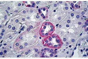 Human Kidney: Formalin-Fixed, Paraffin-Embedded (FFPE)
