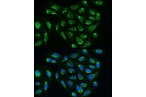 Immunofluorescence analysis of U2OS cells using B Rabbit pAb (ABIN6131454, ABIN6137226, ABIN6137227 and ABIN6224284) at dilution of 1:200 (40x lens).